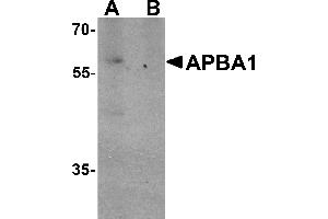 Western blot analysis of APBA1 in rat brain tissue lysate with APBA1 antibody at 0. (APBA1 antibody  (N-Term))