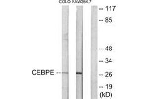Western blot analysis of extracts from LOVO/RAW264. (CEBPD, CEBPE antibody  (AA 171-220))