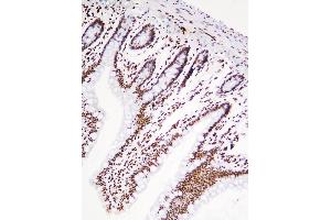 IHC analysis of HNRNPD using anti-HNRNPD antibody (ABIN7602590).