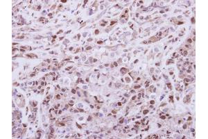 IHC-P Image Immunohistochemical analysis of paraffin-embedded H661 xenograft, using DPF2, antibody at 1:250 dilution. (DPF2 antibody  (Center))