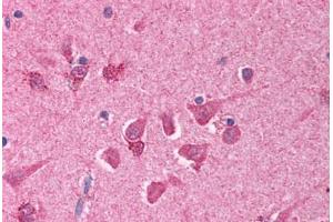 Human Brain, Cortex (formalin-fixed, paraffin-embedded) stained with BCL10 antibody ABIN214608 at 10 ug/ml followed by biotinylated goat anti-rabbit IgG secondary antibody ABIN481713, alkaline phosphatase-streptavidin and chromogen. (BCL10 antibody  (AA 5-19))