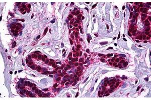 Human Breast: Formalin-Fixed, Paraffin-Embedded (FFPE) (Stromal Antigen 1 antibody  (AA 1112-1221))