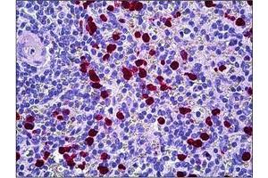 Immunohistochemistry (Paraffin-embedded Sections) (IHC (p)) image for anti-Hepatocyte Growth Factor-Regulated tyrosine Kinase Substrate (HGS) (Internal Region) antibody (ABIN784218)