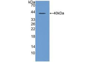 Western blot analysis of recombinant Rat MIP1a. (CCL3 antibody  (AA 24-92))
