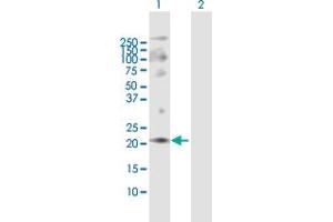 Western Blot analysis of ANAPC10 expression in transfected 293T cell line by ANAPC10 MaxPab polyclonal antibody. (ANAPC10 antibody  (AA 1-185))
