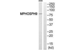 Western blot analysis of extracts from A549 cells, using MPHOSPH9 antibody. (KIF2B antibody  (C-Term))