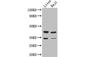 Western Blot Positive WB detected in: Mouse liver tissue, Raji whole cell lysate All lanes: BHMT2 antibody at 3 μg/mL Secondary Goat polyclonal to rabbit IgG at 1/50000 dilution Predicted band size: 41, 34 kDa Observed band size: 41, 34 kDa (BHMT2 antibody  (AA 1-200))