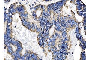 IHC analysis of TOMM70 using anti-TOMM70 antibody (ABIN7599855). (TOM70 antibody  (AA 122-608))