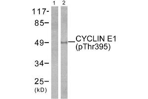 Western Blotting (WB) image for anti-Cyclin E1 (CCNE1) (pThr395) antibody (ABIN1847246)