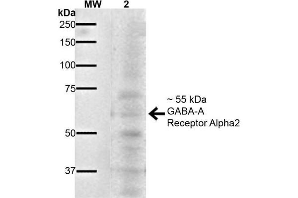 GABRA1 anticorps  (AA 350-385) (HRP)