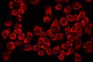 ABIN6275625 staining HeLa by IF/ICC. (CCT8 antibody  (Internal Region))