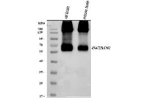 Western blot analysis of EAAT2/GLT-1/SLC1A2 using anti-EAAT2/GLT-1/SLC1A2 antibody (ABIN3043436).