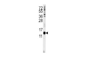 Western blot analysis of anti-CDA Antibody (C-term) (ABIN389393 and ABIN2839485) in Hela cell line lysates (35 μg/lane). (CDA antibody  (C-Term))