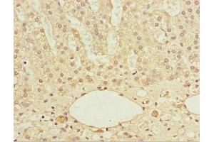 Immunohistochemistry of paraffin-embedded human adrenal gland tissue using ABIN7172122 at dilution of 1:100 (DTYMK antibody  (AA 1-212))