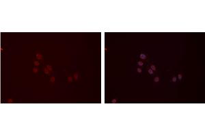 ABIN6277410 staining Hela cells by IF/ICC. (MYL9 antibody  (N-Term))