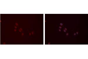 ABIN6277410 staining Hela cells by IF/ICC. (MYL9 antibody  (N-Term))