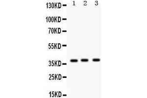 Western Blotting (WB) image for anti-Surfactant Protein D (SFTPD) (AA 292-321), (C-Term) antibody (ABIN3043335) (SFTPD antibody  (C-Term))