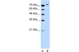 WB Suggested Anti-RHOBTB1 Antibody Titration:  0. (RHOBTB1 antibody  (Middle Region))