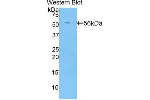 Detection of Recombinant BACE2, Rat using Polyclonal Antibody to Beta Secretase 2 (BACE2) (BACE2 antibody  (AA 242-502))