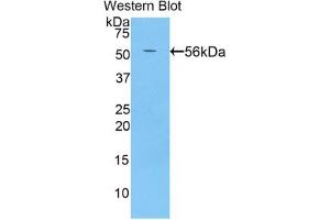 Detection of Recombinant BACE2, Rat using Polyclonal Antibody to Beta Secretase 2 (BACE2)