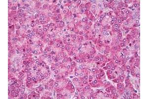 Immunohistochemistry (Paraffin-embedded Sections) (IHC (p)) image for anti-Sodium Channel, Voltage-Gated, Type I, alpha Subunit (SCN1A) antibody (ABIN1108946)