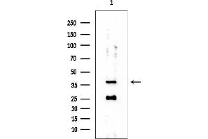 anti-Isovaleryl-CoA Dehydrogenase (IVD) (Internal Region) antibody