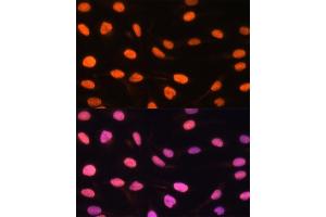 Immunofluorescence analysis of U-2 OS cells using ZBED1 antibody (ABIN6132791, ABIN6150363, ABIN6150364 and ABIN6222539) at dilution of 1:100. (ZBED1 antibody  (AA 1-280))