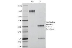 SDS-PAGE Analysis of Purified, BSA-Free Keratin 18 Antibody (clone C-04 or Ks18.