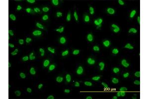 Immunofluorescence of monoclonal antibody to SNAI2 on HeLa cell. (SLUG antibody  (AA 97-169))