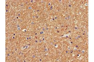 Immunohistochemistry of paraffin-embedded human brain tissue using ABIN7154472 at dilution of 1:100 (GADD45G antibody  (AA 1-159))