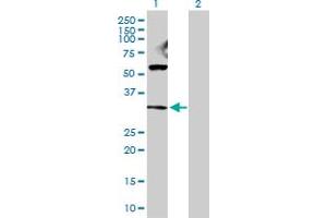 Lane 1: GAP43 transfected lysate ( 24. (GAP43 293T Cell Transient Overexpression Lysate(Denatured))