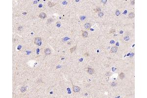 Immunohistochemistry analysis of parafffin-embedded rat brain using P2RX3 Polyclonal Antibody at dilution of 1:400.