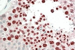 ABIN5868646 (5 µg/ml) staining of paraffin embedded Human Testis. (HOXA10 antibody)