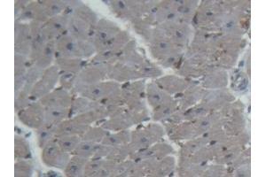 #VALUE! (FABP4 antibody  (AA 2-132))