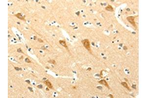 The image on the left is immunohistochemistry of paraffin-embedded Human brain tissue using ABIN7131272(SYT5 Antibody) at dilution 1/15, on the right is treated with fusion protein. (Synaptotagmin V antibody)