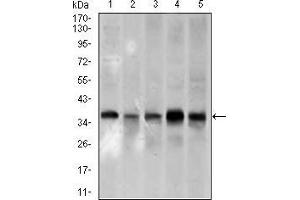 Western blot analysis using PCNA mouse mAb against A431 (1), HeLa (2), HepG2 (3), Raji (4), and MOLT4 (5) cell lysate. (PCNA antibody  (AA 53-196))