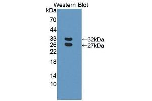Detection of Recombinant BCAM, Human using Polyclonal Antibody to Basal Cell Adhesion Molecule (BCAM) (BCAM antibody  (AA 32-257))