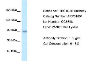 WB Suggested Anti-TBC1D2B Antibody   Titration: 1. (TBC1D2B antibody  (C-Term))