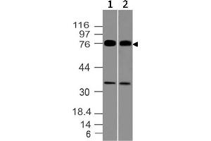 Image no. 1 for anti-Melanoma Associated Antigen (Mutated) 1 (MUM1) (AA 52-278) antibody (ABIN5027376)