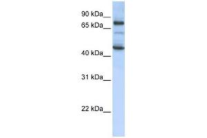 GAS2L1 antibody used at 1 ug/ml to detect target protein. (GAS2L1 antibody  (Middle Region))