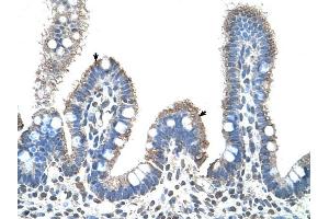 SLC22A1 antibody was used for immunohistochemistry at a concentration of 4-8 ug/ml to stain Epithelial cells of intestinal villus (arrows) in Human Intestine. (SLC22A1 antibody)