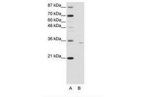 Image no. 1 for anti-Orthopedia Homeobox (OTP) (C-Term) antibody (ABIN6736160) (OTP antibody  (C-Term))