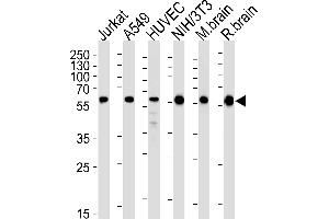 Western blot analysis of lysates from Jurkat, A549, HUVEC, mouse NIH/3T3 cell line and mouse brain, rat brain tissue lysates (from left to right), using RAD23B Antibody (N-term) (ABIN1944896 and ABIN2843646). (RAD23B antibody  (N-Term))
