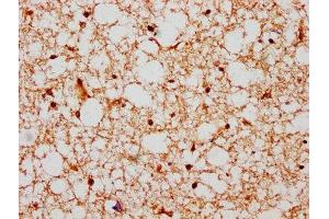 IHC image of ABIN7155411 diluted at 1:600 and staining in paraffin-embedded human brain tissue performed on a Leica BondTM system.