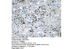 Human Liver (SCD antibody  (Middle Region))