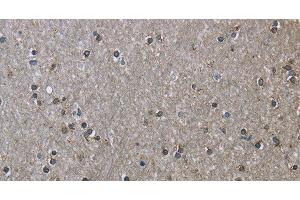 Immunohistochemistry of paraffin-embedded Human brain using HSPA9 Polyclonal Antibody at dilution of 1:50 (HSPA9 antibody)