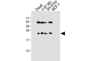All lanes : Anti-PRL Antibody (Center) at 1:1000 dilution Lane 1: Daudi whole cell lysate Lane 2: U-87 MG whole cell lysate Lane 3: SH-SY5Y whole cell lysate Lane 4: MCF-7 whole cell lysate Lysates/proteins at 20 μg per lane. (Prolactin antibody  (AA 48-76))