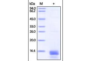 Human S100A14, His Tag on SDS-PAGE under reducing (R) condition. (S100A14 Protein (AA 1-104) (His tag))