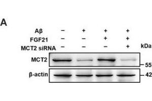 The roles of MCTs in the beneficial effects of FGF21. (SLC16A7 antibody  (C-Term))