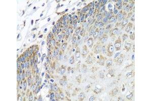 Immunohistochemistry of paraffin-embedded Human esophagus using TMOD3 Polyclonal Antibody at dilution of 1:100 (40x lens). (TMOD3 antibody)